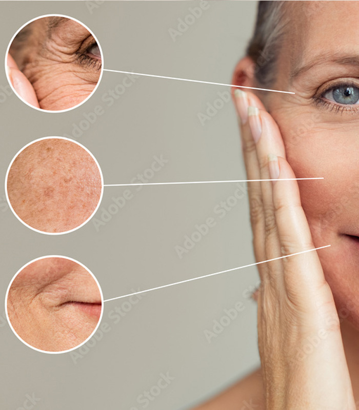 Hautarztpraxis Birgit Hoyer Faltenbehandlung