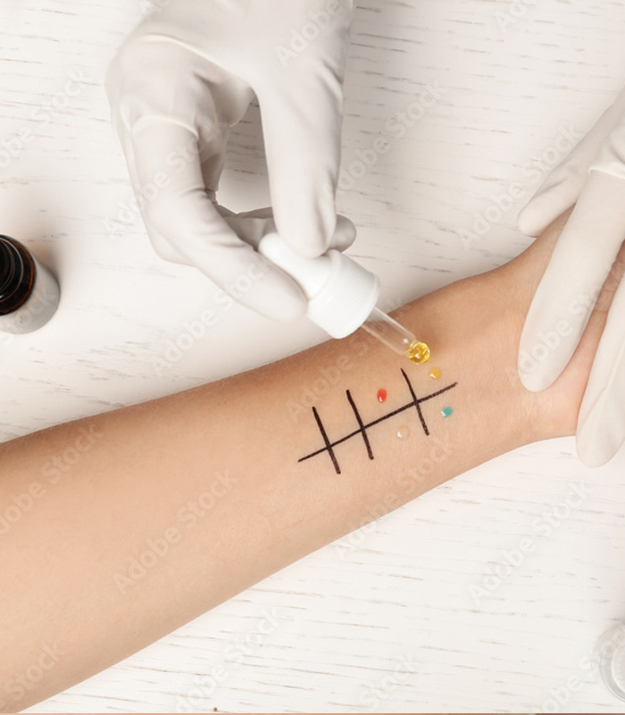 Hautarztpraxis Birgit Hoyer Allergologie